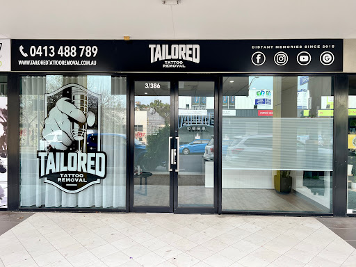 Tailored Tattoo Removal