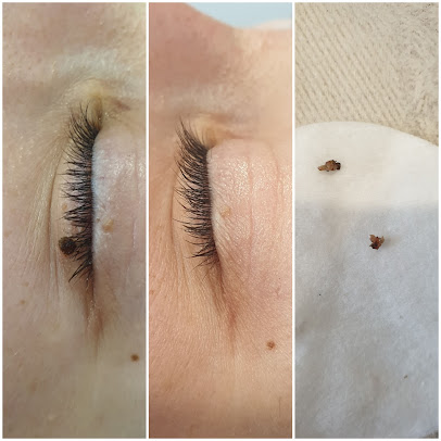 Beautilase - Beautilase