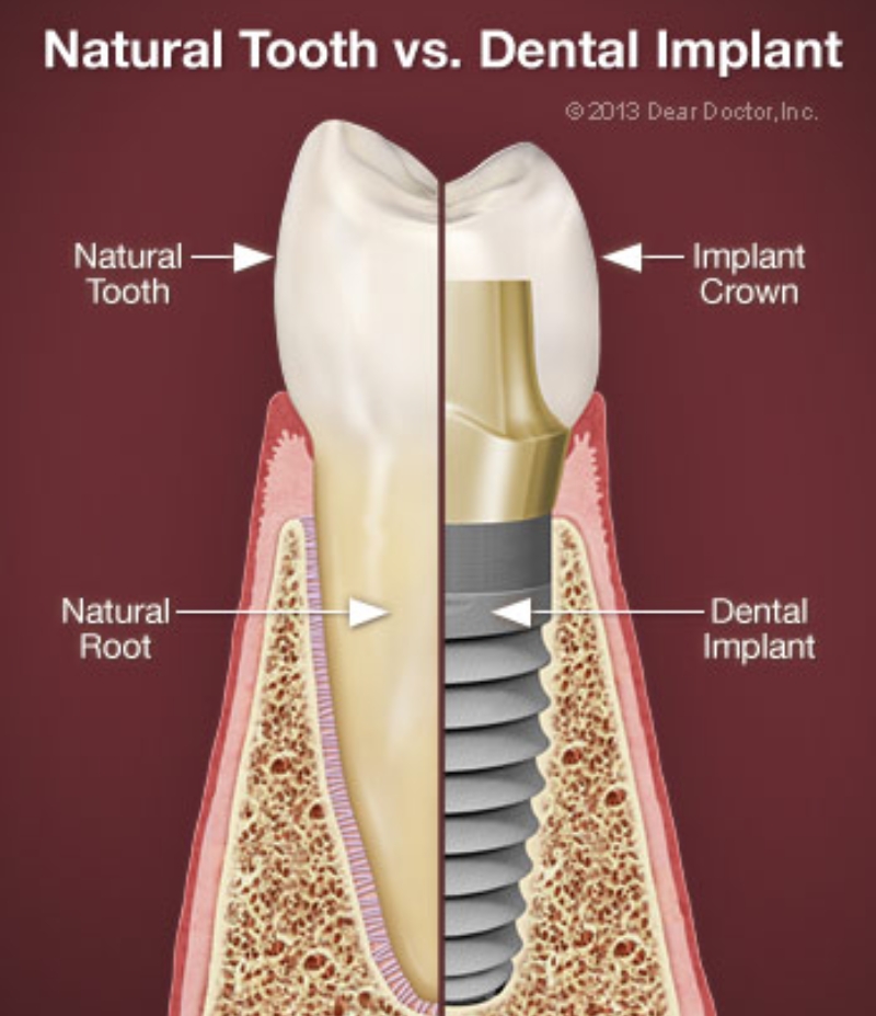 Dental comfort