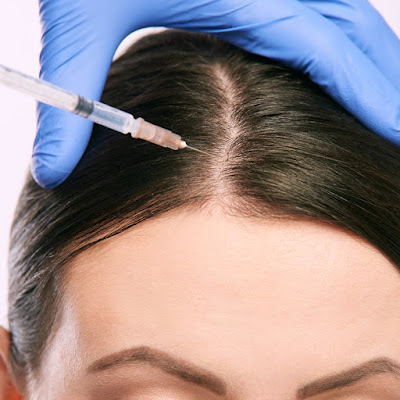 Dr Pascal BOUDJEMA | Greffe de cheveux à Paris | Technique FUE & FUT à Paris