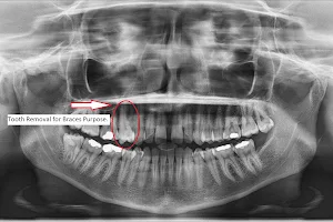 Roxburgh Park Dental Clinic - Dr Bassam Attar image