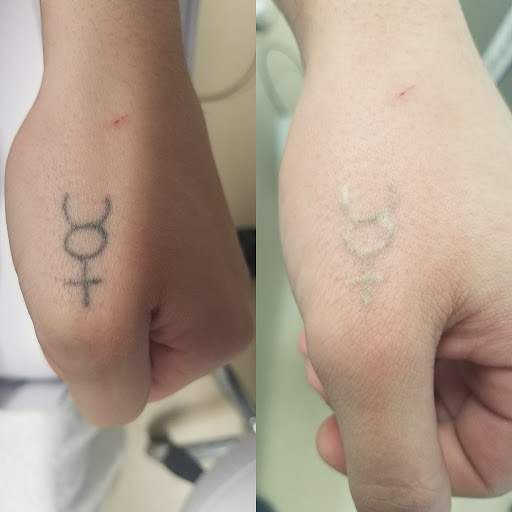 Explore tattoo ideas for traveling, creative tattoo ideas in Wakefield, available at New Beginnings Laser Tattoo Removal