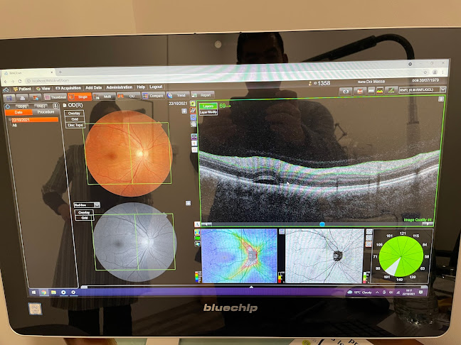 Optician in Colchester | Optical Revolution – Eye Care Clinic - Optician
