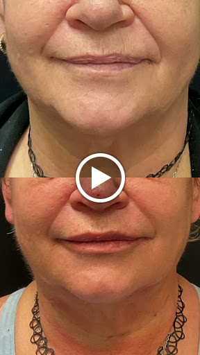 Explore black and gray tattoo sleeve ideas, creative tattoo ideas in Lake Oswego, available at Lake Oswego Vein and Aesthetic LOVA