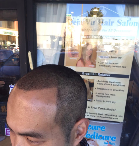 Hair replacement service Thousand Oaks
