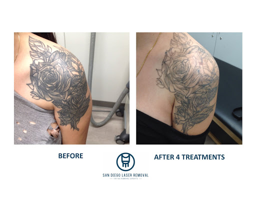 Explore sister tattoo ideas for 4, creative tattoo ideas in San Diego, available at Removery Tattoo Removal & Fading