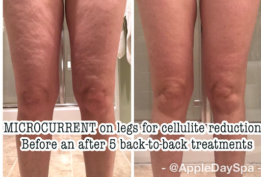 Day Spa «Apple Day Spa & Hair Restoration Salon», reviews and photos, 152 Grandview Ave, Honesdale, PA 18431, USA