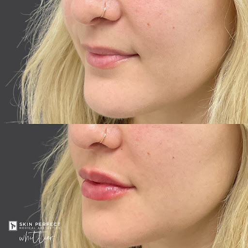 Explore above the knee tattoo ideas, creative tattoo ideas in Whittier, available at Skin Perfect Medical Aesthetics