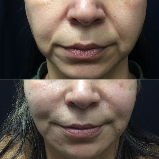 Explore 2 dog tattoo ideas, creative tattoo ideas in Lake Oswego, available at Lake Oswego Vein and Aesthetic LOVA