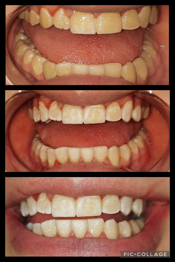 Explore wedding finger tattoo ideas, creative tattoo ideas in Weatherford, available at TCO BEAUTY BAR & Waxing Studio Weatherford Tx