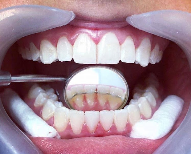 Comentarii opinii despre CLINICA DENTAL CEIBOSDENT