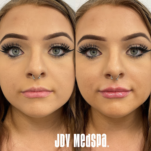 Explore venezuela tattoo ideas, creative tattoo ideas in Canton, available at JDV Med Spa