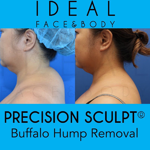 Ideal Face & Body image