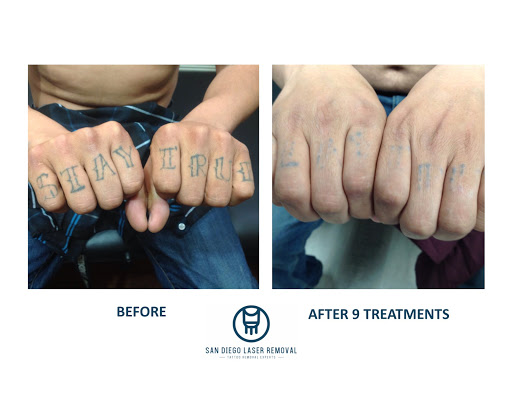 Explore shoulder blade tattoo ideas, creative tattoo ideas in San Diego, available at Removery Tattoo Removal & Fading