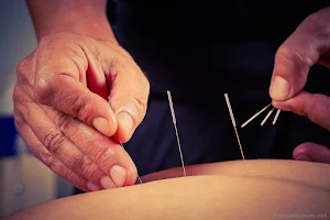 Instituto Yáo Murcia: masajes y medicina tradicional china. image
