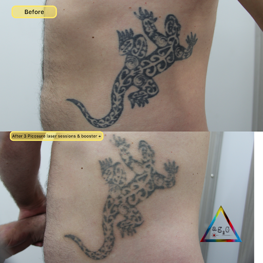 Explore good forearm tattoo ideas, creative tattoo ideas in New York, available at Ag2g Laser Tattoo Removal & MedSpa