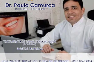 Dr. Paulo Camurça - Tratamento de Canal Laser PDT - Endodontista - Dentista Fortaleza ALDEOTA- FACETAS DE RESINA E PRÓTESE image