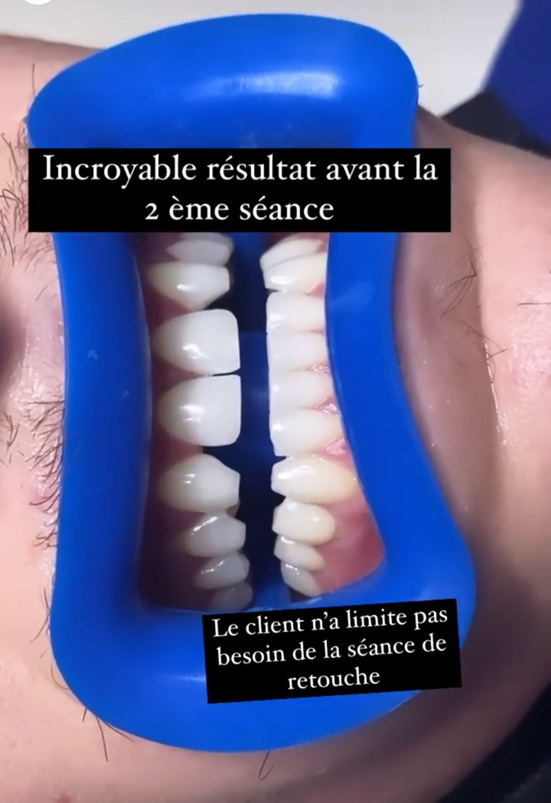 Photo n° 2 de l'avis de Émile.e fait le 06/09/2021 à 16:17
