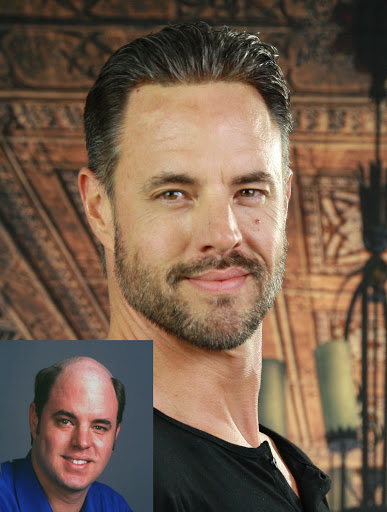 Hair Replacement Service «Elite Solutions Hair Loss Specialists of Sacramento», reviews and photos, 9294 Madison Ave, Orangevale, CA 95662, USA