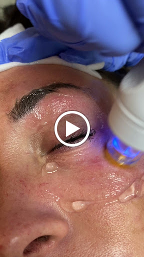 Explore racing tattoo ideas, creative tattoo ideas in Foley, available at Baldwin GYN & Aesthetics