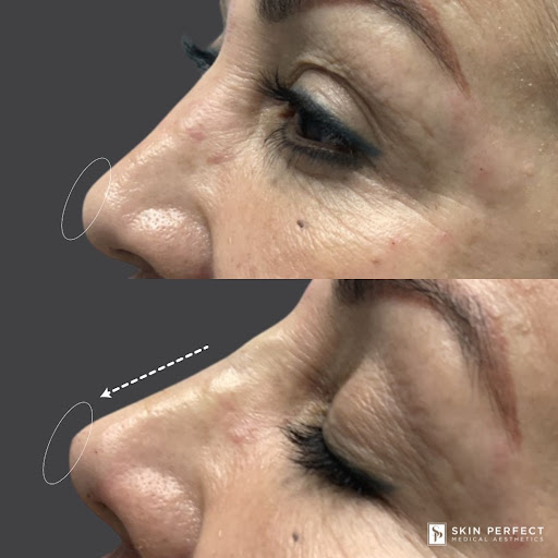 Explore warhammer 40k tattoo ideas, creative tattoo ideas in Whittier, available at Skin Perfect Medical Aesthetics