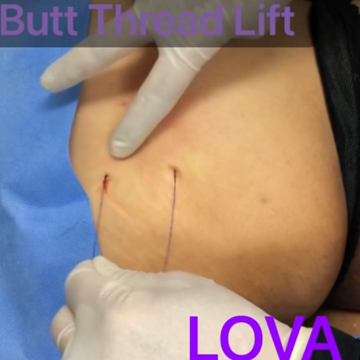 Explore 2 initial tattoo ideas, creative tattoo ideas in Lake Oswego, available at Lake Oswego Vein and Aesthetic LOVA