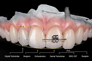 DentMax İstanbul Ağız ve Diş Sağlığı Polikliniği / invisalign - implant - lamine image