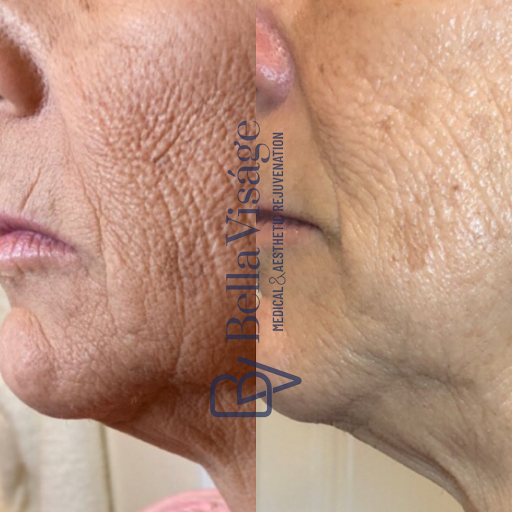 Explore bipolar tattoo ideas, creative tattoo ideas in Lakeland, available at Bella Visge Medical & Aesthetic Rejuvenation