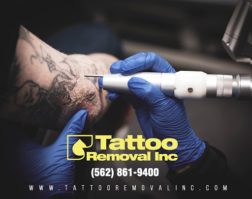 Explore cherub angel tattoo ideas, creative tattoo ideas in South Gate, available at Tattoo Removal Inc