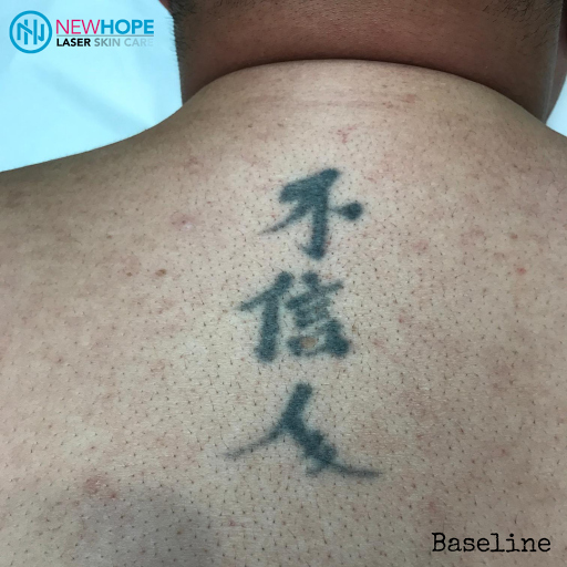 Explore 1776 tattoo ideas, creative tattoo ideas in Westminster, available at Newhope Laser Skin Care