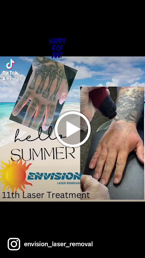 Explore medical doctor tattoo ideas, creative tattoo ideas in Port Charlotte, available at Envision Laser Removal