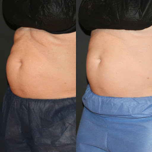 Explore dog grooming tattoo ideas, creative tattoo ideas in Summit, available at Ethos Aesthetics and Wellness, Laser Hair Removal and Med Spa