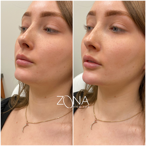 Skin Care Clinic «ZONA MED SPA», reviews and photos, 9767 N 91st St #102, Scottsdale, AZ 85258, USA