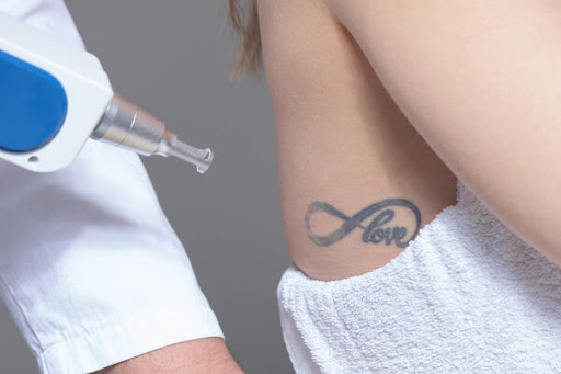 Explore roses tattoo ideas, creative tattoo ideas in Mcallen, available at Regenerate Laser