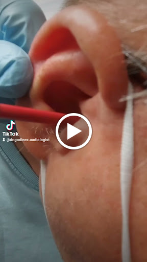 Sherman Oaks Ear and Hearing Aid institute - Tinnitus, Musician Devices, Hearing Loss Specialist image