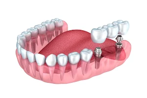Dentessential - Dentist Richmond NSW image