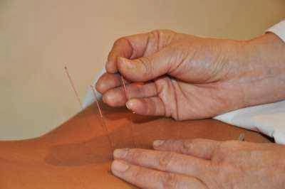 Aku-Punkt Gabinet akupunktury