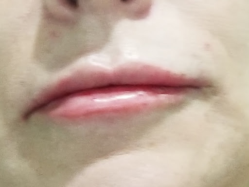 Medical Spa «New Image Medical Spa», reviews and photos, 680 Mowry Ave, Fremont, CA 94536, USA