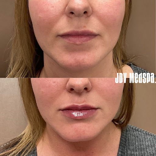 Explore safari tattoo ideas, creative tattoo ideas in Canton, available at JDV Med Spa