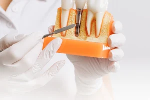 Centre Dentaire Orthodontie Serris - Dentalign Dentiste Orthodontie Implant dentaire Aligneurs invisibles. image
