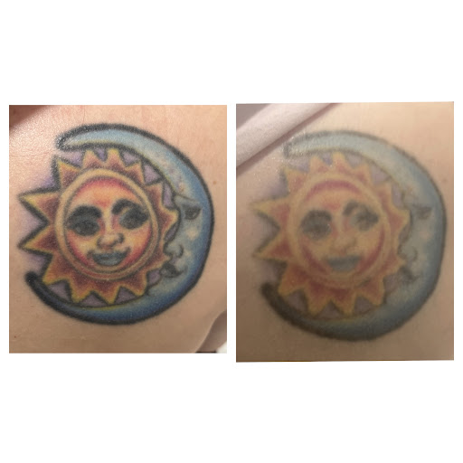 Explore 2008 tattoo ideas, creative tattoo ideas in Orlando, available at Laser Procedure of Florida