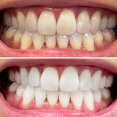 Lovelysmiles Teeth Whitening Newmarket