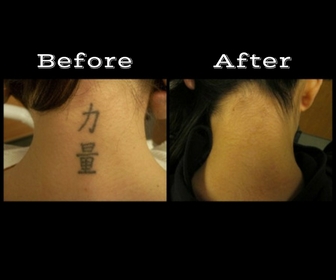 Explore ftm tattoo ideas, creative tattoo ideas in Longview, available at Vanish Laser Aesthetics
