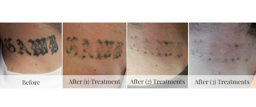 Explore colour tattoo sleeve ideas, creative tattoo ideas in Adrian, available at TatFreeMD Tattoo Removal Specialists