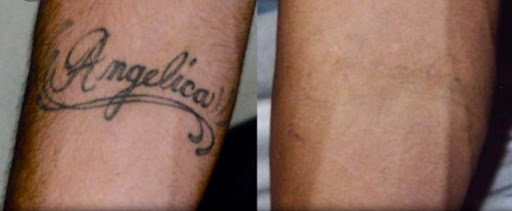 Explore cool hand tattoo ideas, creative tattoo ideas in Middle Village, available at Bye Bye Ink Laser Tattoo Removal