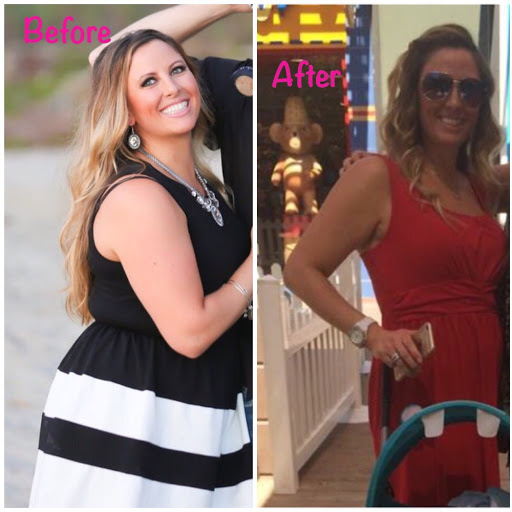 OC Weight Loss Centers & CoolSculpting image
