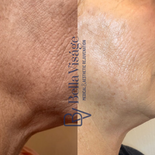 Explore ideas for spine tattoos, creative tattoo ideas in Lakeland, available at Bella Visge Medical & Aesthetic Rejuvenation