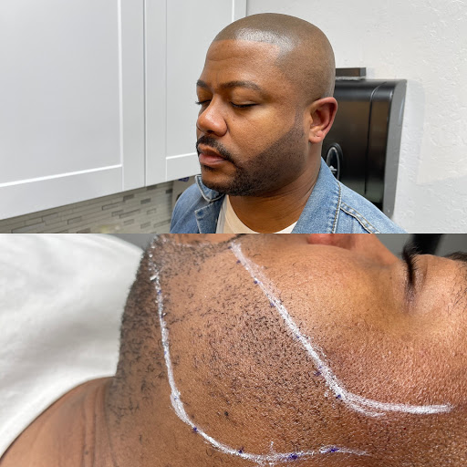 Explore bouquet tattoo ideas, creative tattoo ideas in Roseville, available at NuHair Ink. Scalp MicroPigmentation & Aesthetic Clinic of Sacramento