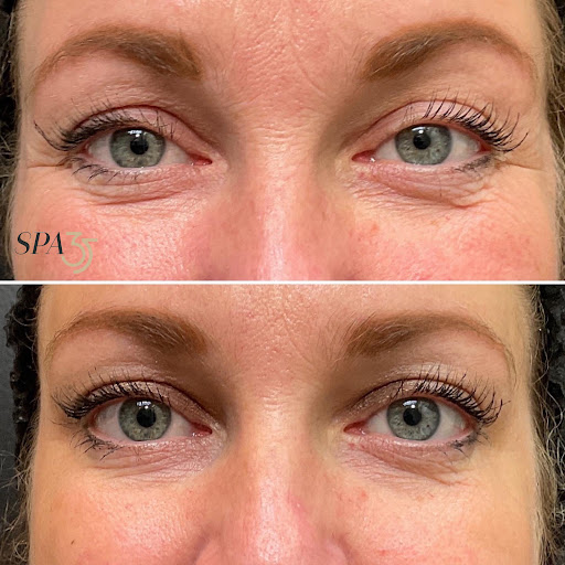 Explore nature tattoo ideas for men, creative tattoo ideas in Boise, available at Spa 35 Med Spa