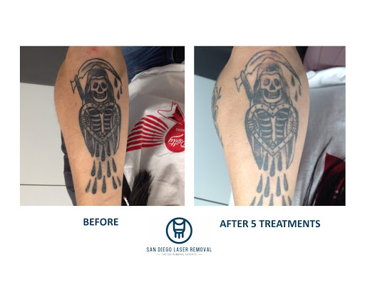 Explore son name tattoo ideas for mom, creative tattoo ideas in San Diego, available at Removery Tattoo Removal & Fading